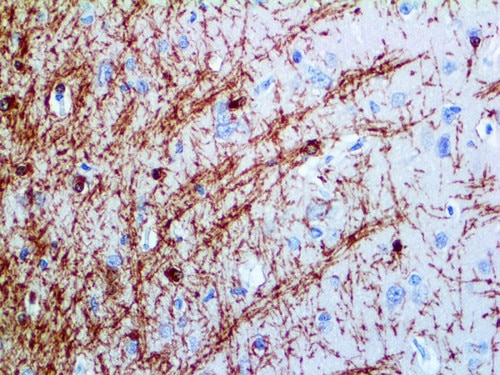 IHC of Myelin Basic Protein MBT on an FFPE Brain Tissue